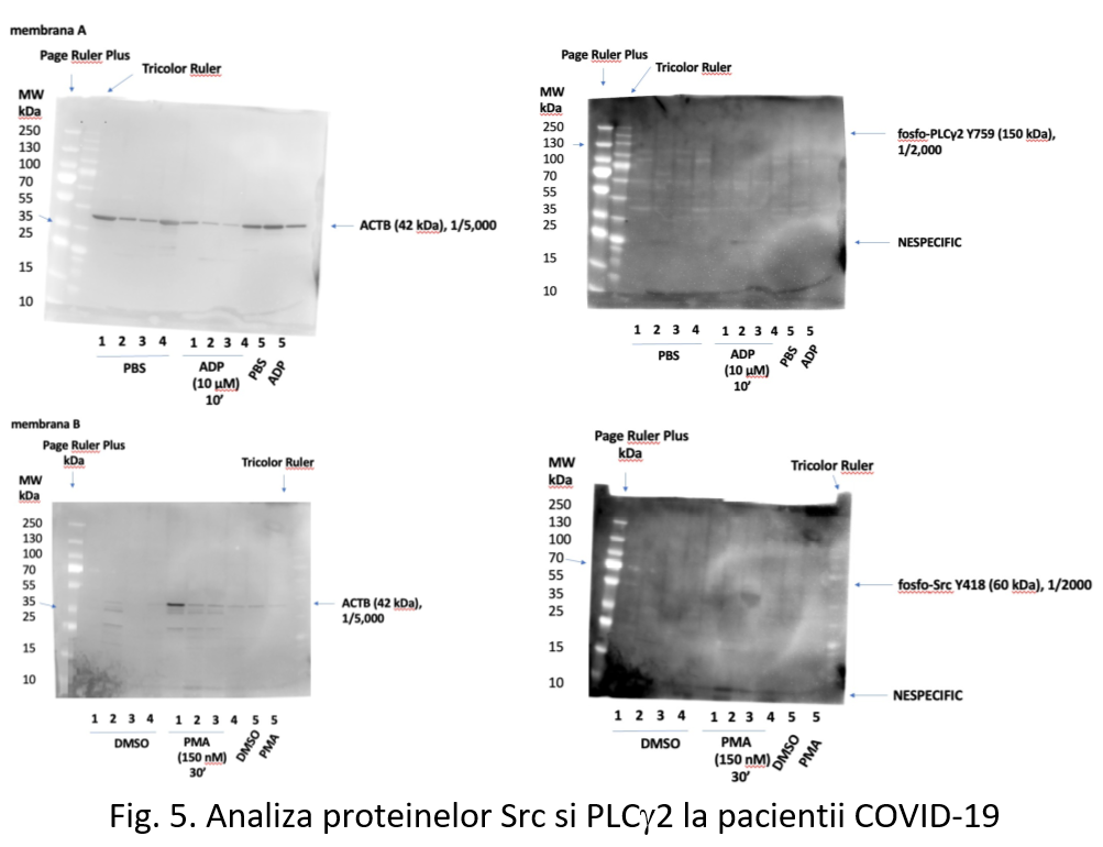 Analiza proteinelor Src si Plcy2 la pacientii COVID-19